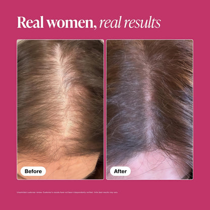 Viviscal Hair Growth Supplements for Women, 60 Tablets, 1 Month Thicker, Fuller Hair Support for Women with Biotin & Marine Collagen, Helps Reduce Hair Shedding, Drug Free